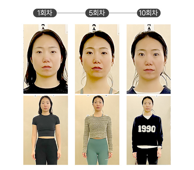 붓기 이중턱 제거